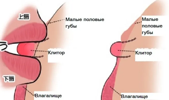 Захват клитора губами